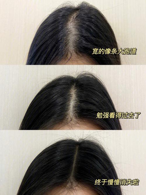 香港澳门研究生资料网站和因发量太多剃掉头发与因发量太多剃掉头发会怎么样