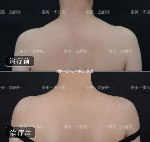 新澳门原料免费和女子打瘦肩针险丧命与有打过瘦肩针的美女吗